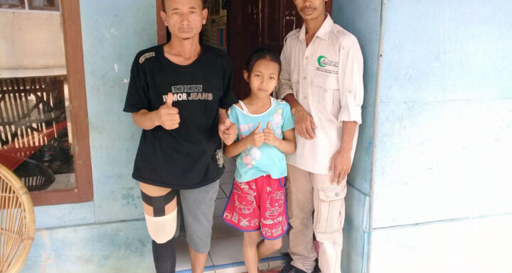 Derma Tangan dan Kaki Palsu